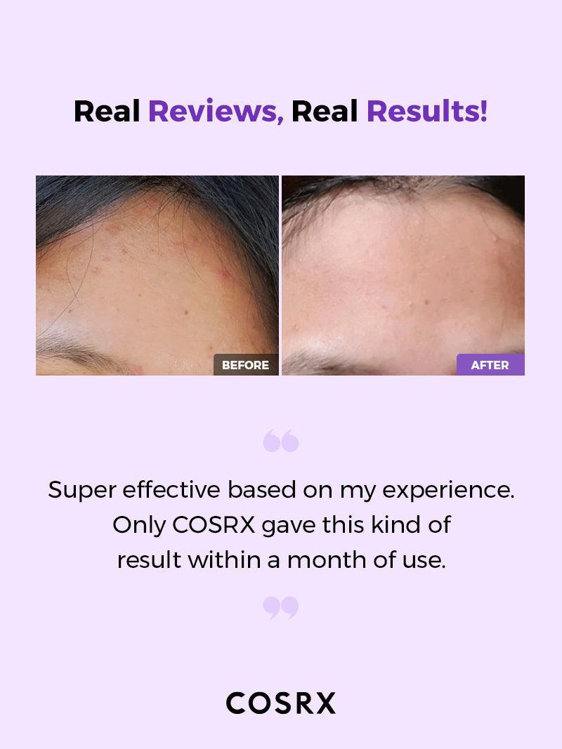 COSRX AHA/BHA Clarifying Treatment Toner 150ML