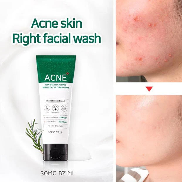 SOME BY MI AHA-BHA-PHA 30 DAYS MIRACLE ACNE CLEAR FOAM 100ML