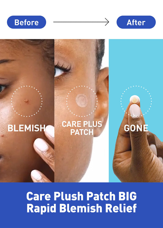 OLIVE YOUNG CARE PLUS COVER SPOT PATCH BIG 81PCS