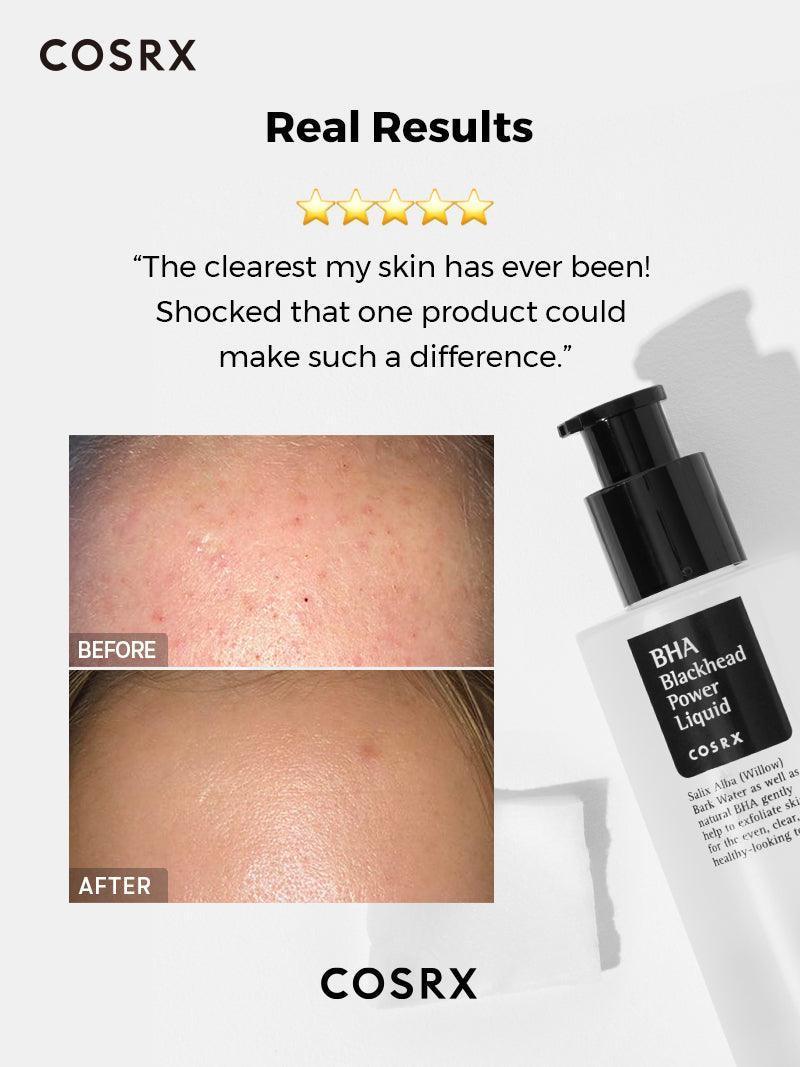 COSRX BHA Blackhead Power Liquid 100ML